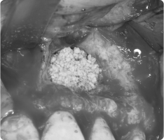 비구개관낭종02