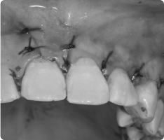 비구개관낭종03